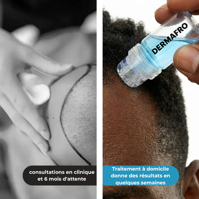 Micro Infusion sur Homme Noir  - Derma Afro