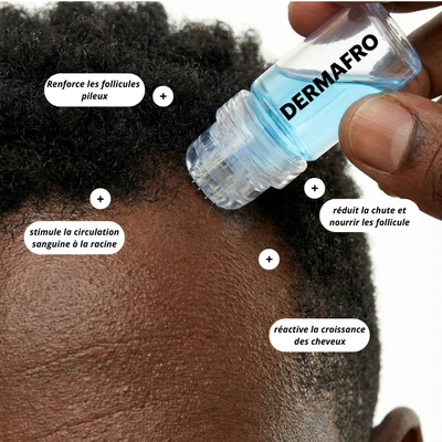 Micro Infusion sur Homme Noir  - Derma Afro