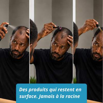 Micro Infusion sur Homme Noir  - Derma Afro